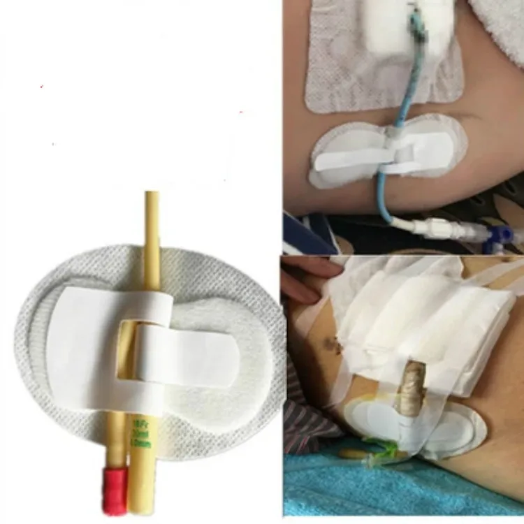 11pcs/veliko foley kateter imetnik ventilatorji omejeno palico kateter nego non-woven lepilo imetnik sterilizirati, fiksna cev size11*6 cm
