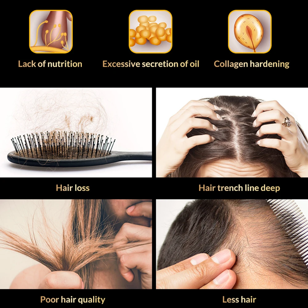 Anti Hair Loss Rast Las Spray Eterično Olje, Tekočine Za Moške, Ženske Suhe Lase Regeneracijo Popravila,Izdelkov, Izguba Las