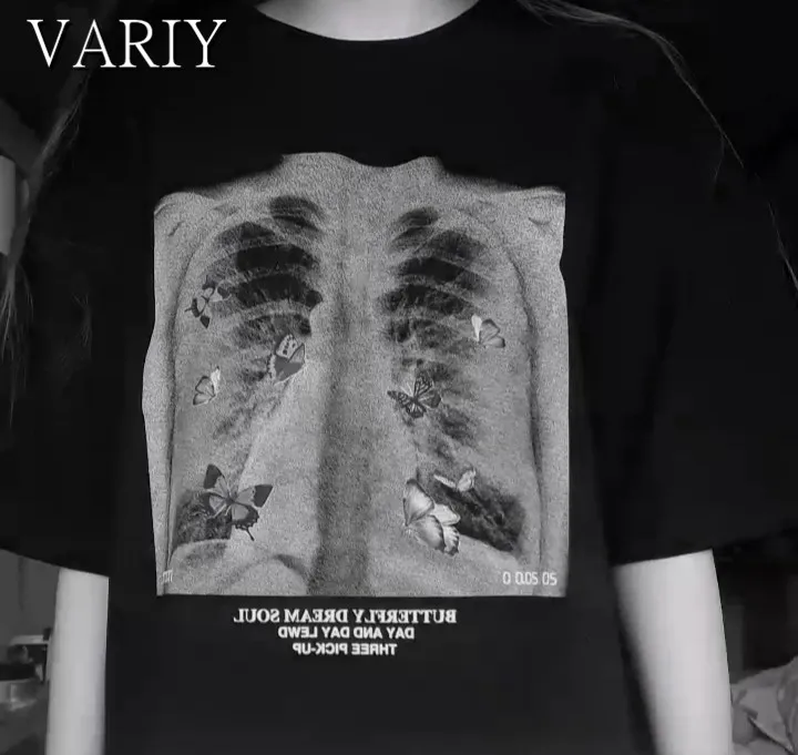 Beli metulj X ray Sliko Vrhovi Majica Retro Ženska T-Shirt Harajuku Hip HopTshirt Prevelik t shirt Poletje plus velikost tshirt