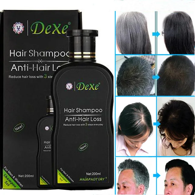 Dexe profesionalni Šampon za rast Dlak Anti hair Loss Kitajski Rast Las Izdelek Preprečevanje Las Zdravljenja za Moške & Ženske