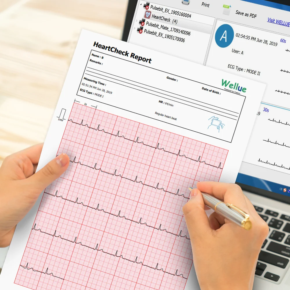 EKG/EKG Srca Monitor za Aritmija Afib 30s-5 min Meritev Podporo Leadwire Bluetooth Brezplačno APLIKACIJO PC Poročilo, Wellue Pulsebit EX