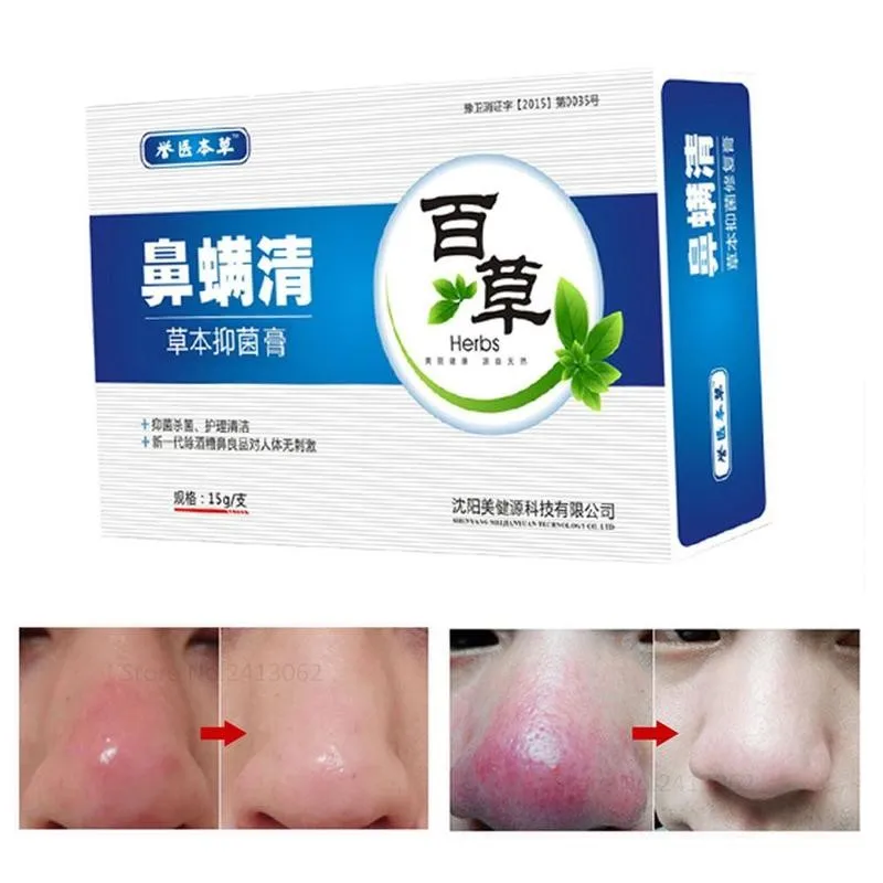 Kitajski Zeliščni Medicini Zeliščni Anti Nos Pršic Odstrani Akne Rosacea Krema Rdeči Nos Blackhead Odstranjevalec Zdravljenje Aken, Skrči Pore