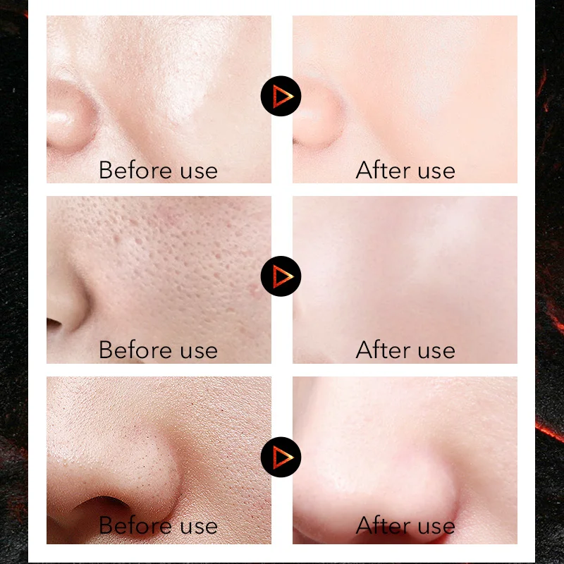 MOŠKI KODE 150 ml Moški Vulkanskega Blata Facial Cleanser Moisturizing Facial Cleanser Olje-nadzor Globinsko Čiščenje s Peno Faciales Nego