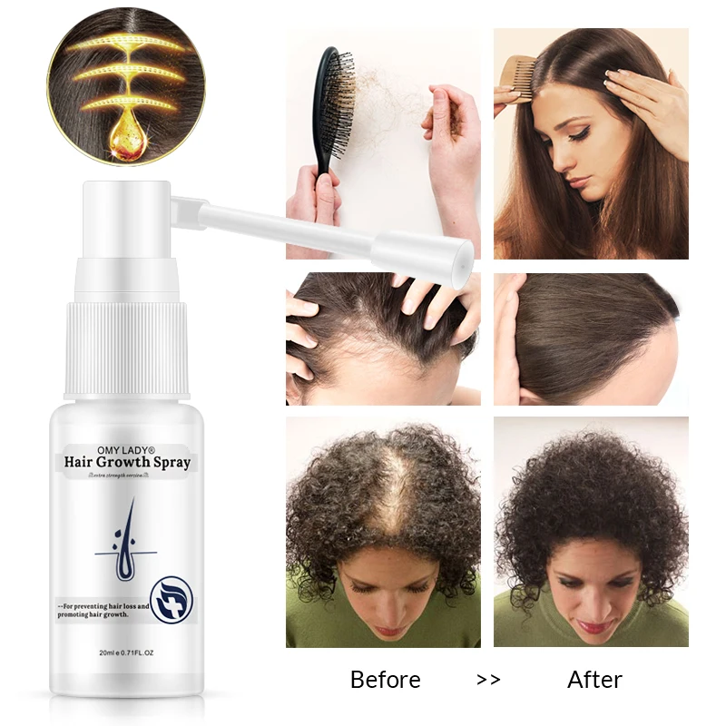 OMY DAMA Las Rast tekočina Spray za nego Las Eterično Olje Izboljšanje preprečiti izpadanje las, Okrepi Lasne korenine serum za lase bistvo 1pcs