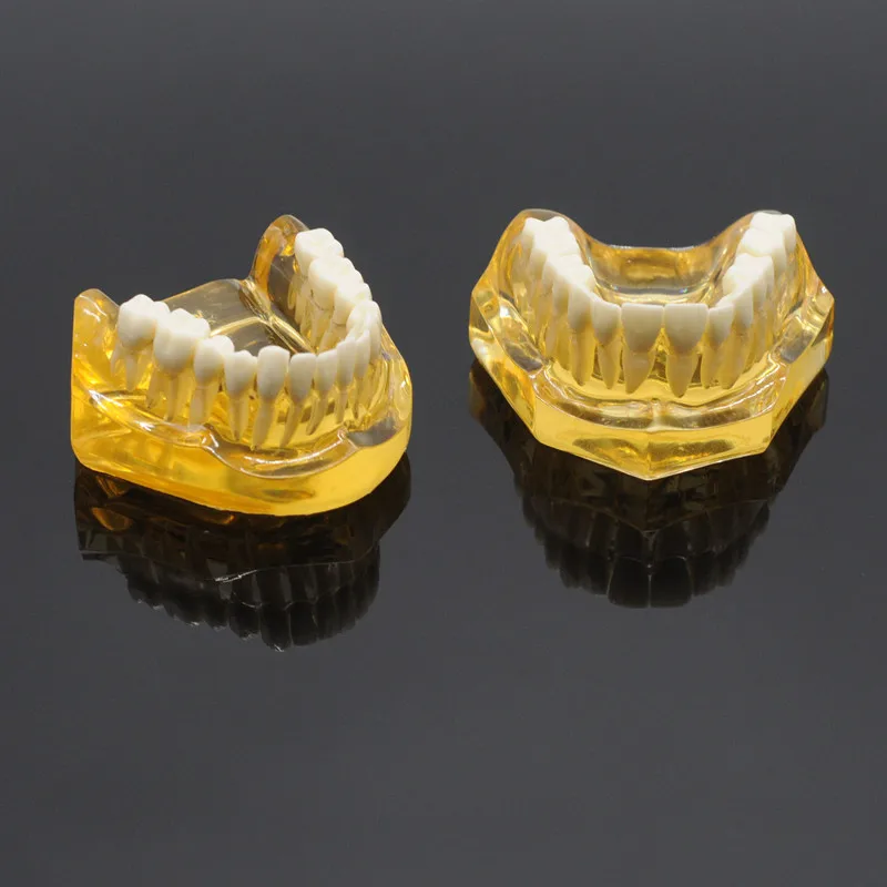 Zobni Izmenljive Zobe Odraslih Typodont Model Vsadek Bolezni Zob Zobozdravnik, Laboratorij Oprema
