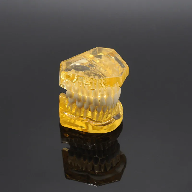 Zobni Izmenljive Zobe Odraslih Typodont Model Vsadek Bolezni Zob Zobozdravnik, Laboratorij Oprema
